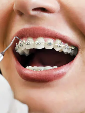 orthodontics dental clinic ludhiana