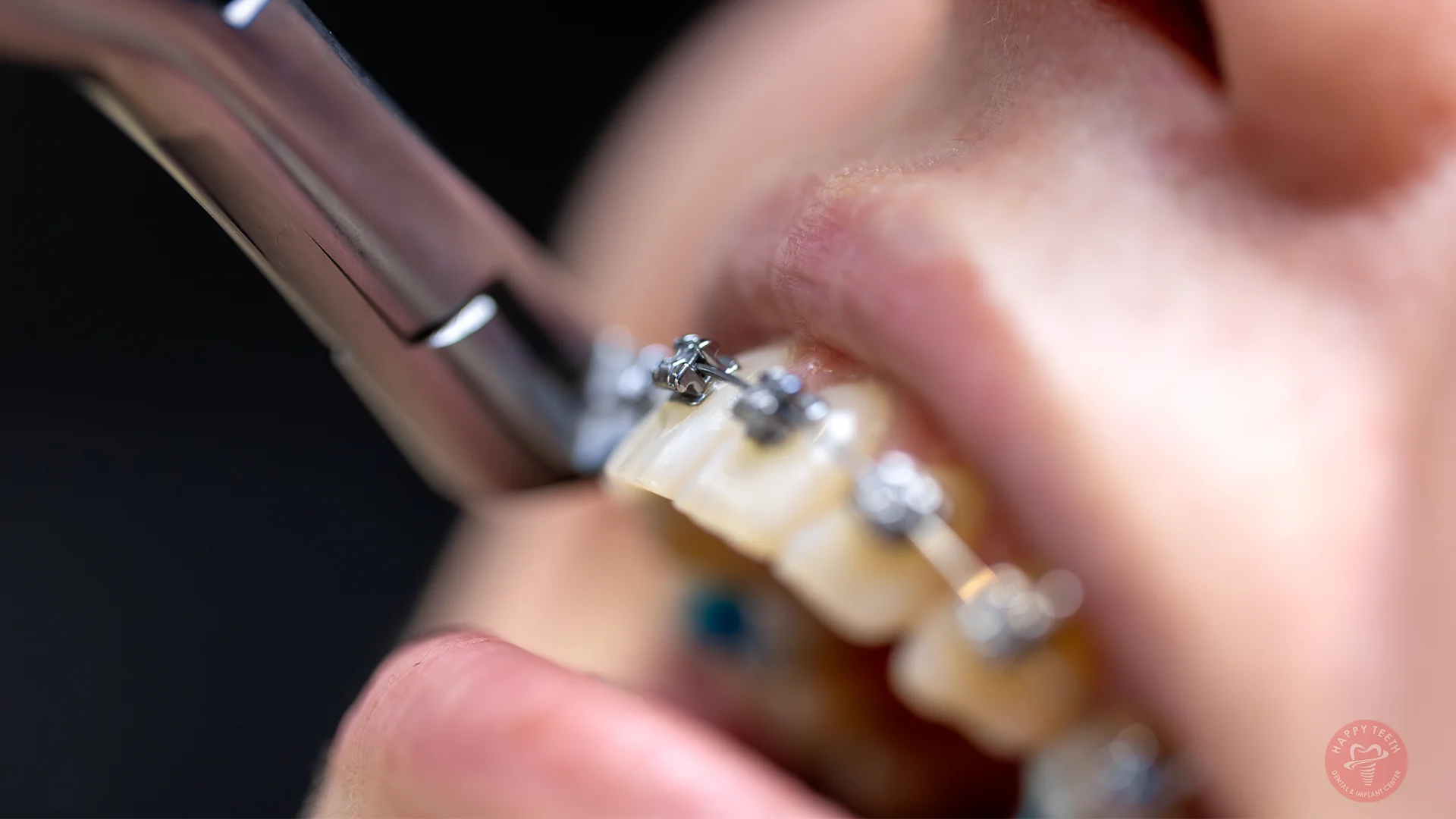 Tooth Gems and Grills on a Smiling Mouth