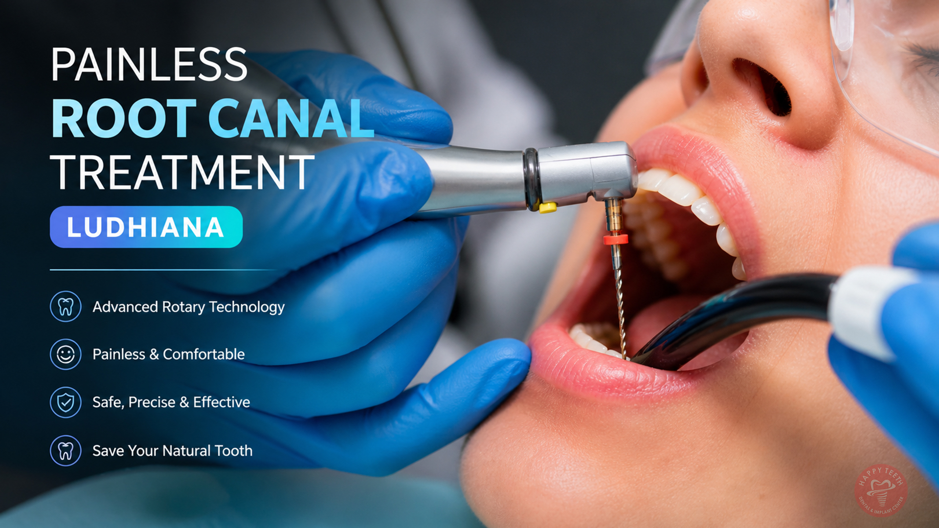 A close-up of a painless Root Canal Treatment Ludhiana being performed with rotary instruments.